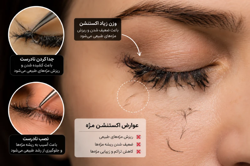 عوارض اکستنشن مژه چیست؟ آیا اکستنشن باعث ریزش مژه های طبیعی میشود؟